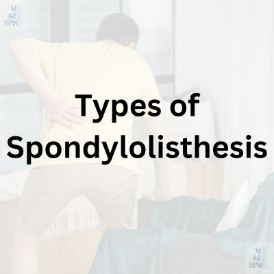 llustration highlighting different types of spondylolisthesis, including congenital, isthmic, and degenerative causes.